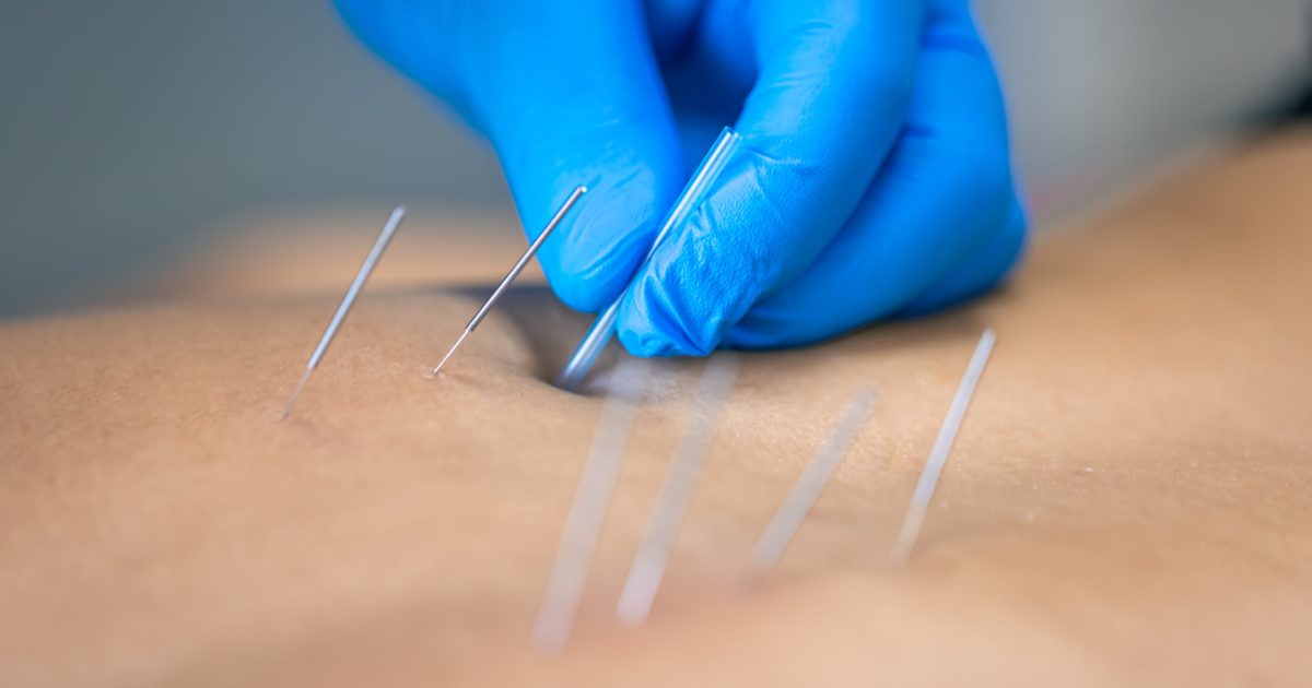 Atendimento fisioterapêutico
